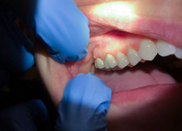 Best Mobile Emergency Dentist in Petersburg, IN
