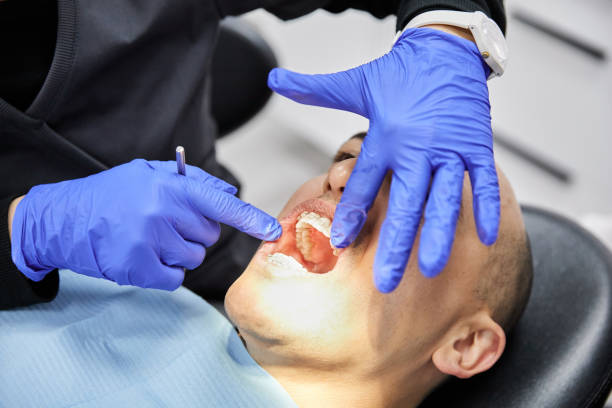 Best Emergency Root Canal Treatment in Petersburg, IN