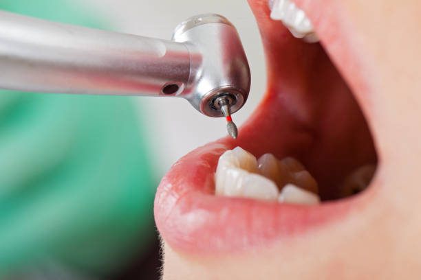 Best Emergency Dentist for Special Needs Patients in Petersburg, IN